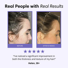 Lavuré P3 Scalp Massager