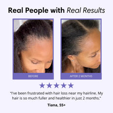 Lavuré P3 Scalp Massager