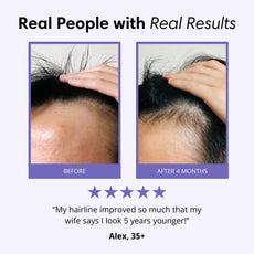 Lavuré P3 Scalp Massager