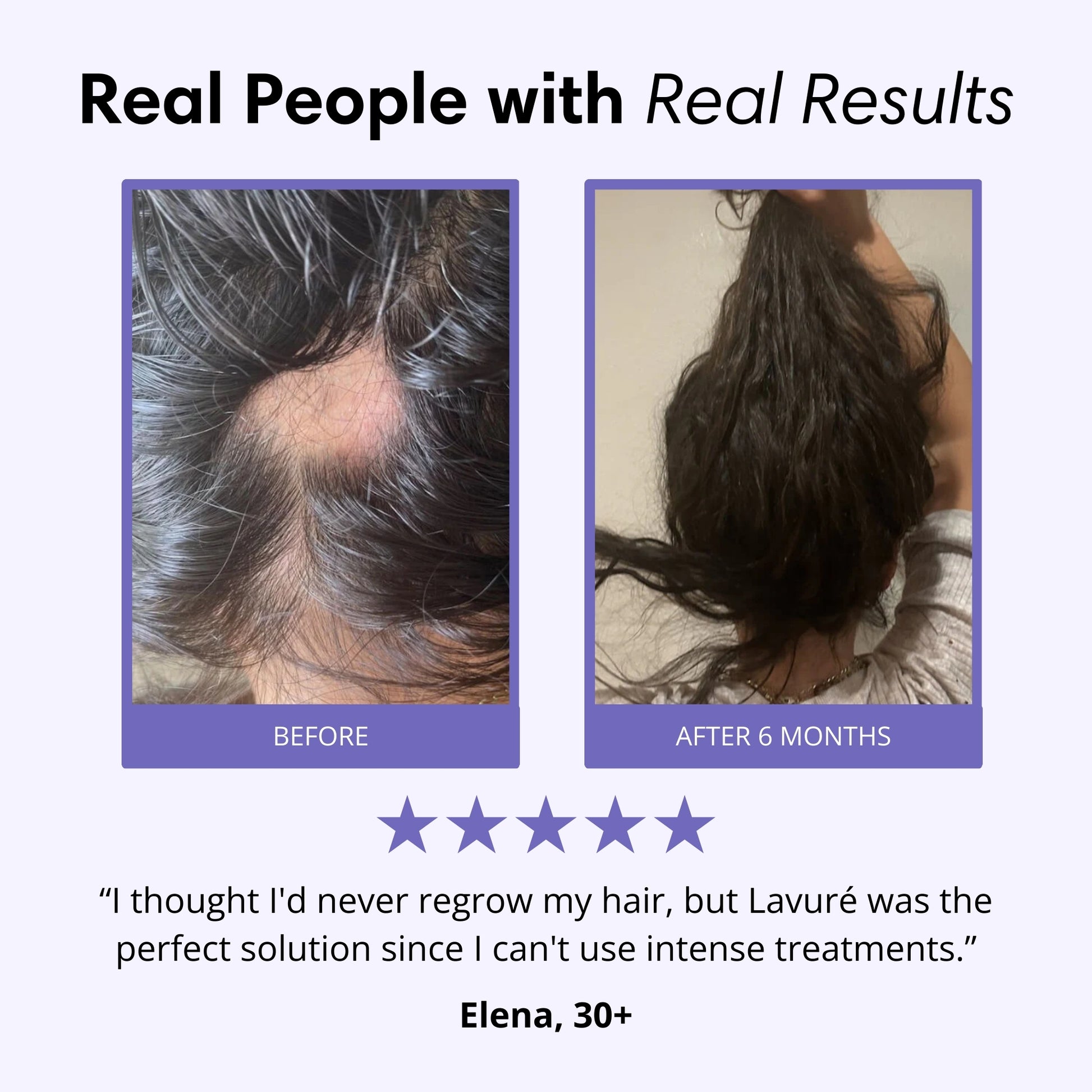 Lavuré P3 Scalp Massager