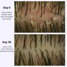 Lavuré LUXE Hair Growth Serum